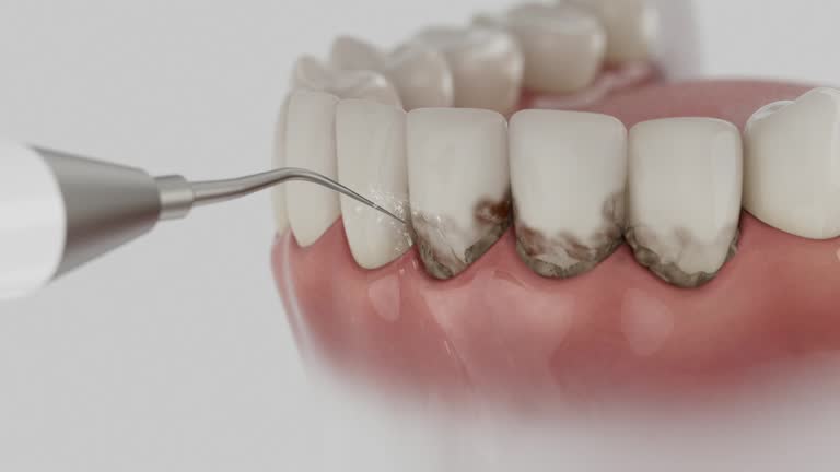 Trusted Root Canal Treatment service in Ganado, TX - Dentist Open Now